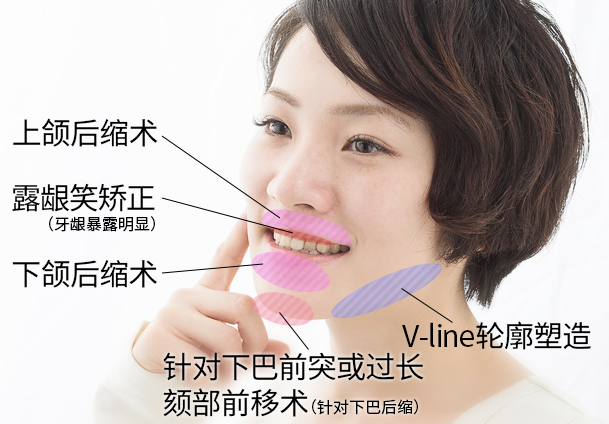 部位